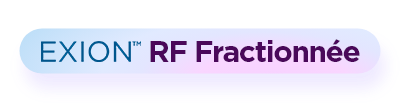 Exion_Fractional-RF_Button_FR100