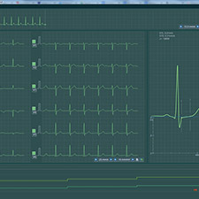 BTL-CardioPoint-Ergo_300_2_ECG_recording