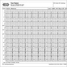 BTL-Cardiopoint-Ergo_report_1-sample-ECG_strip